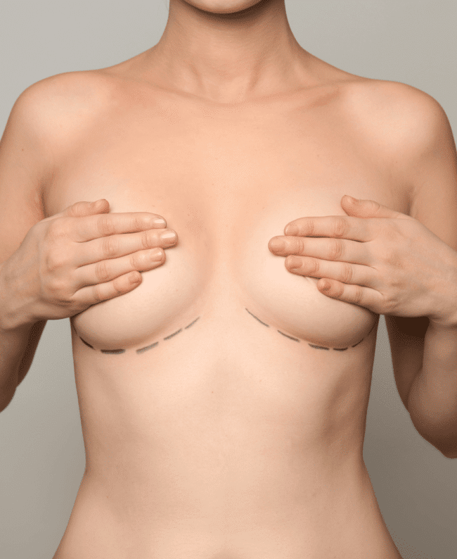 best breast augmentation in southern alberta