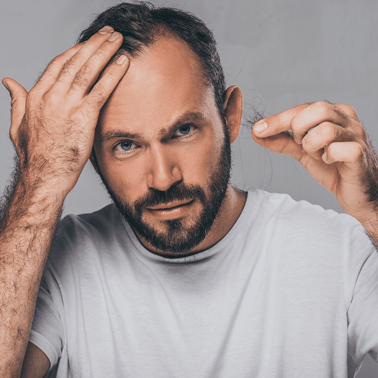 male baldness treatment Lethbridge Alberta
