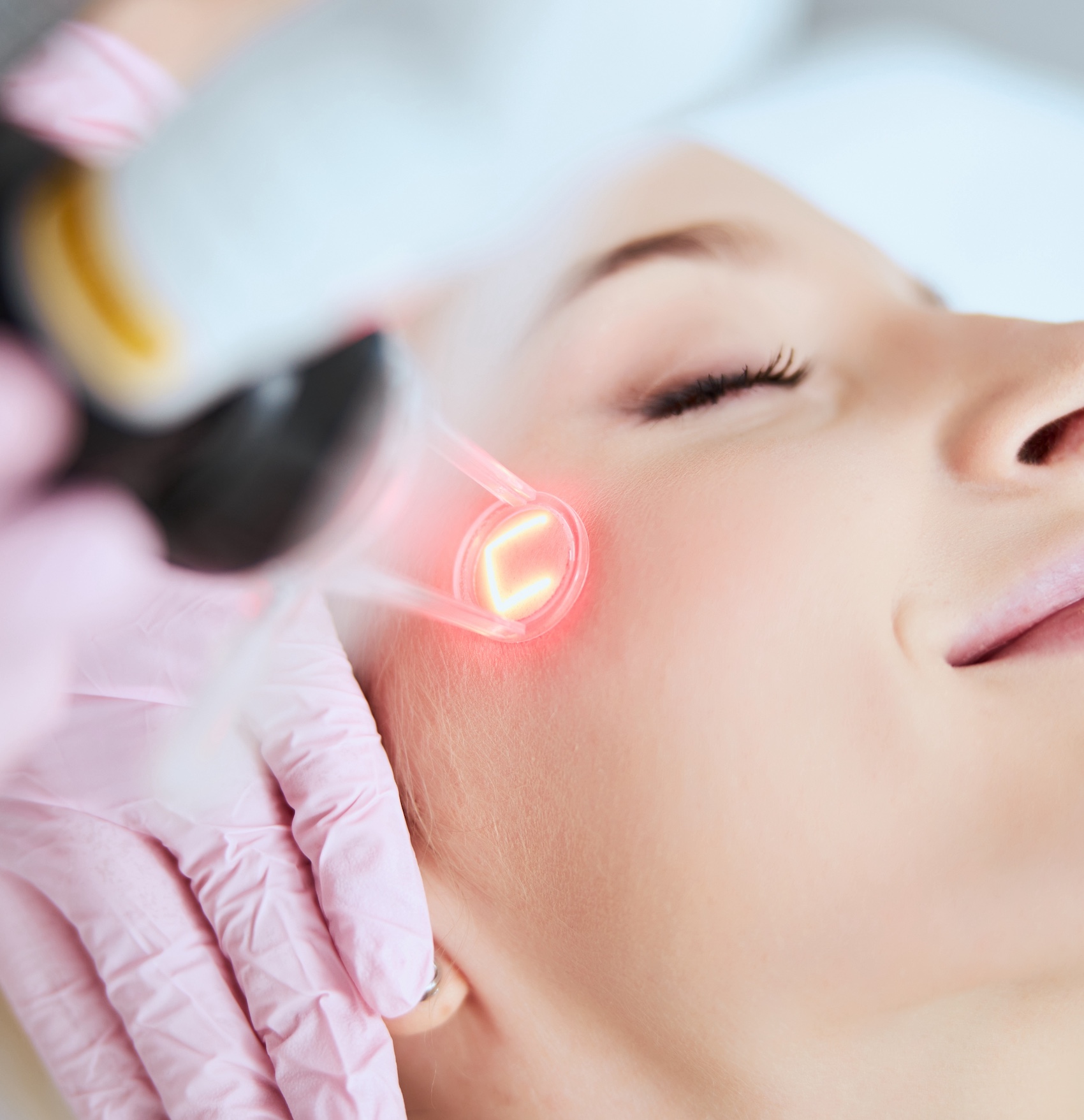 Cosmetic laser treatment on a woman’s cheek at a skincare clinic
