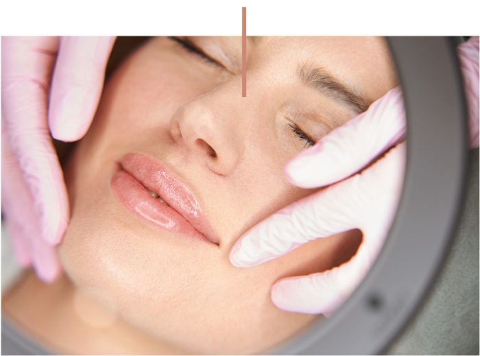 Close-up of a woman receiving a facial skin treatment with gloved hands and magnifying lamp