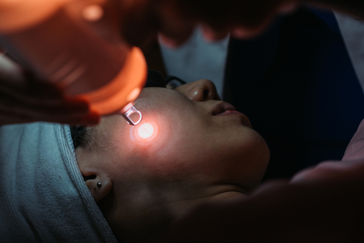 Laser skin treatment on a woman's cheek during a cosmetic procedure