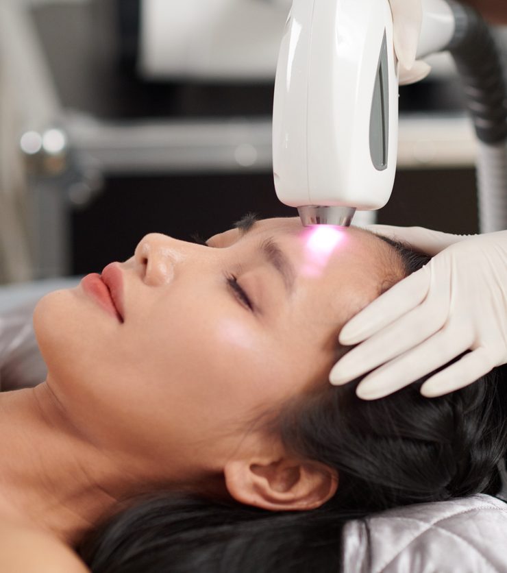 Woman receiving laser skin treatment on her forehead at a spa clinic