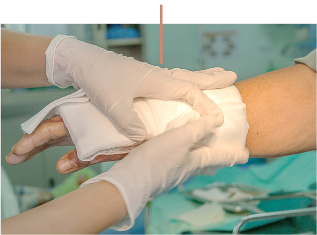 Gloved medical worker applying a bandage to a patient’s hand in a hospital setting