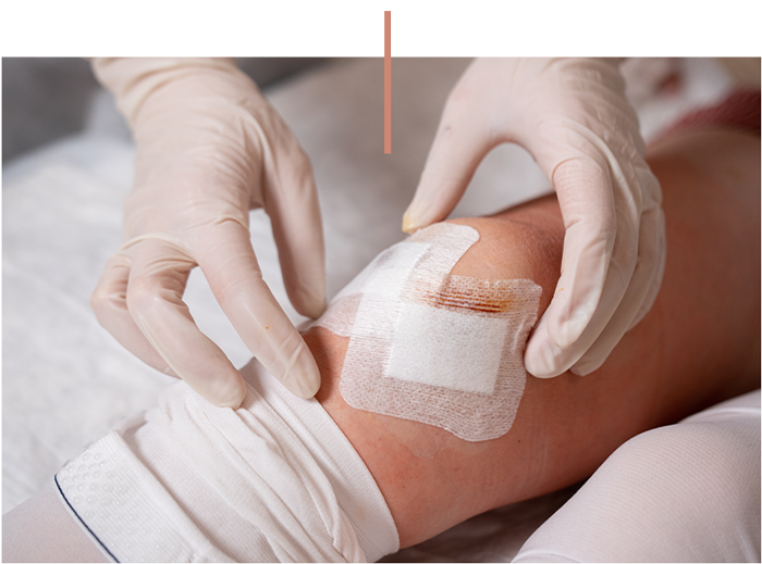 Gloved medical professional changing a bandage on a patient’s knee