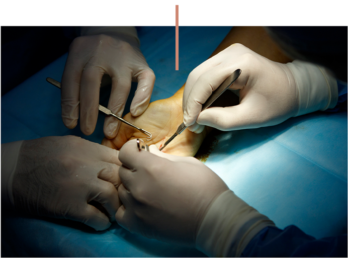 Surgeons performing hand surgery on a patient in an operating room