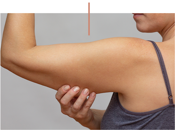 Woman examining her upper arm for muscle tone