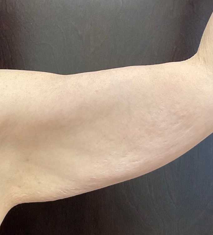 Close-up of a person's bent arm against a dark background