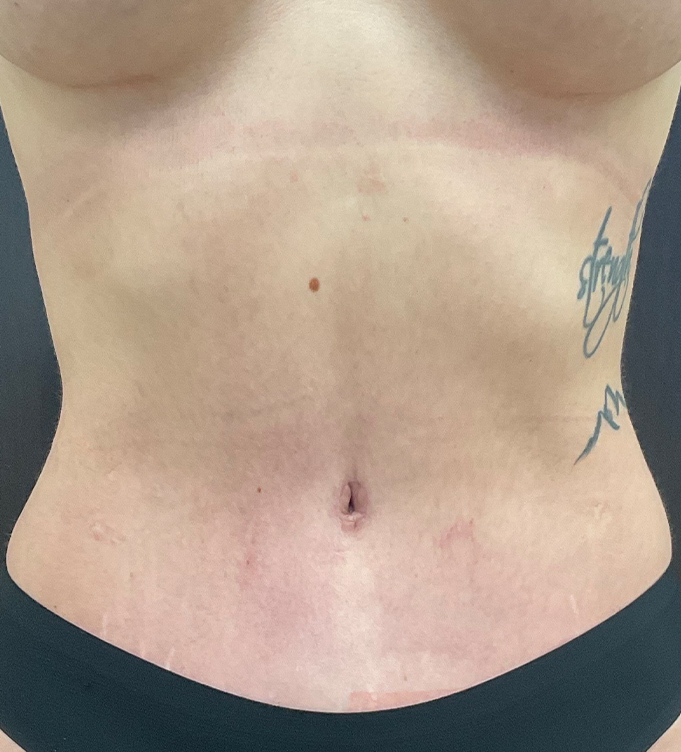 Bare torso of a person with a tattoo on the side and black waistband
