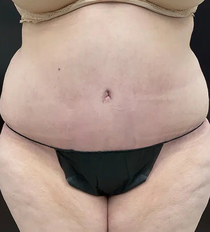 Close-up of a person’s midsection in black underwear against a dark background