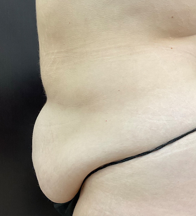 Close-up of a person’s lower back and waist in black underwear