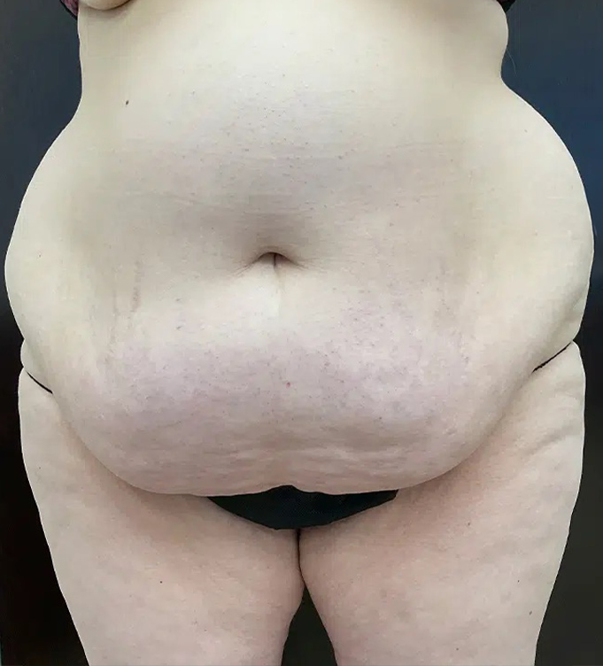 Close-up of a person’s midsection and thighs in black underwear